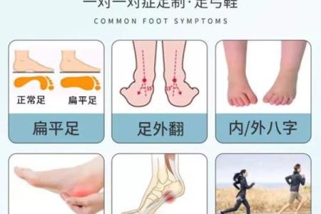 纠正外八字脚