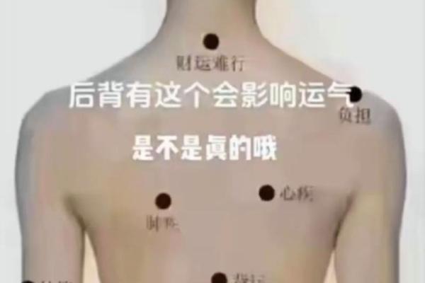 背部胎记算命，背部有胎记会怎样