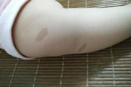 看胎记位置算命