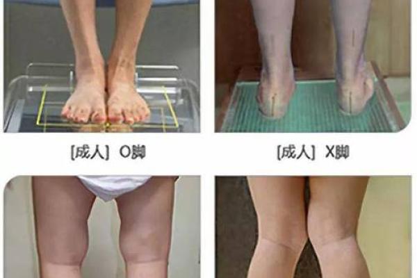 八字脚腿