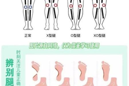 八字脚腿