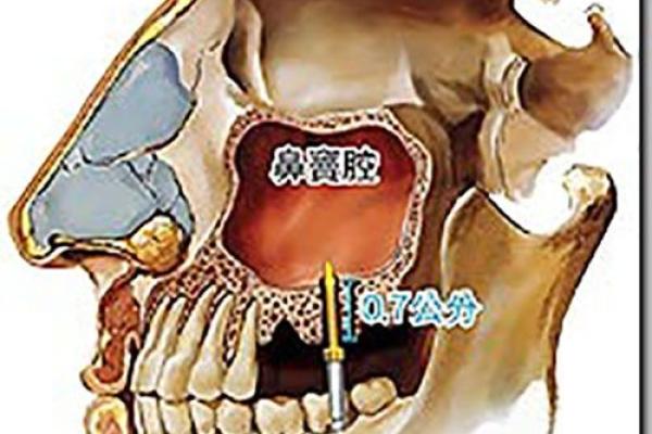 足脊健康知识小课堂（第三期） -  外八字篇