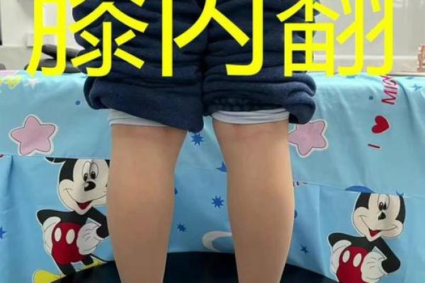 小腿内八字