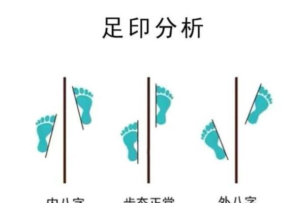 2岁八字脚