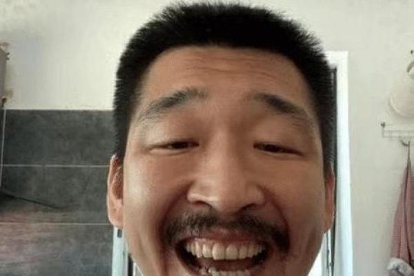 八字胡斑