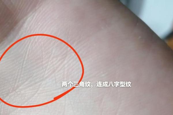 怎么去八字纹